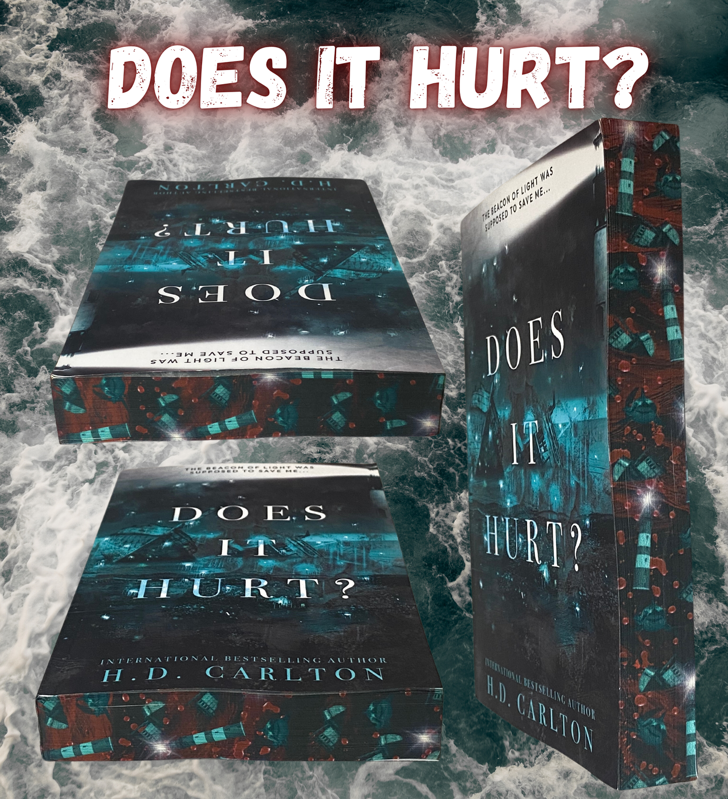 Does it Hurt Paperback